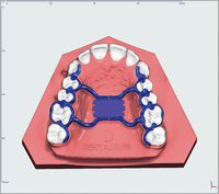 Tornillo RPE hyrax®,  Mini - 7